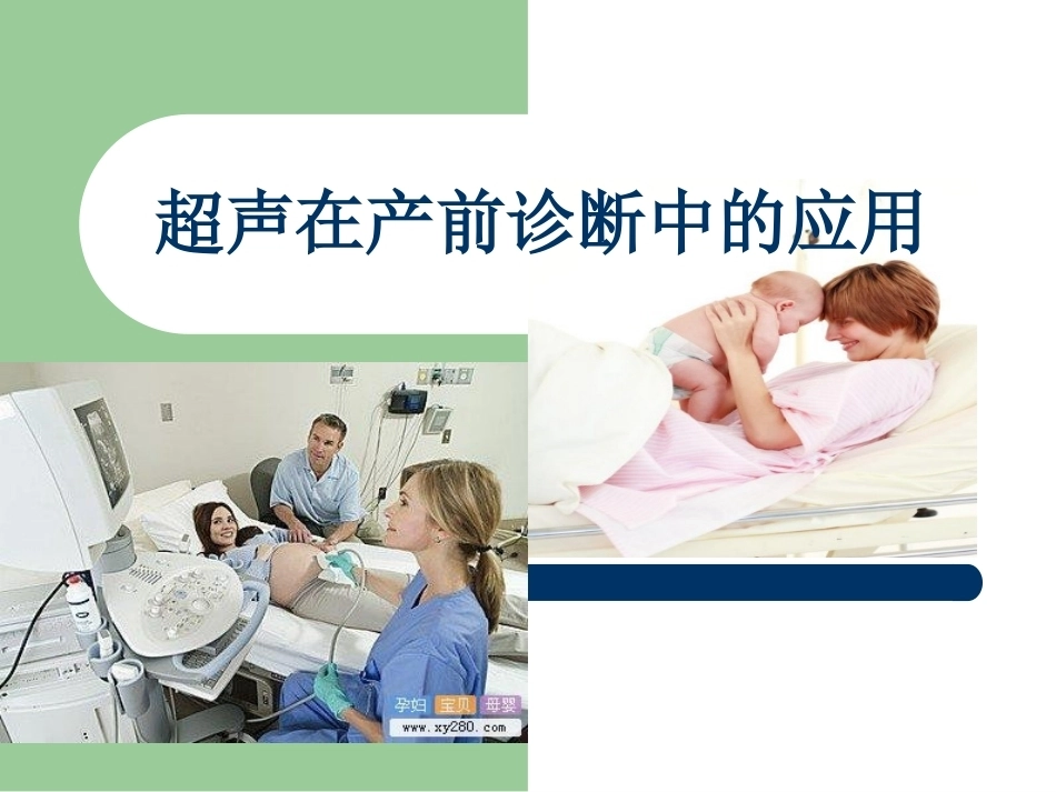 超声在产前诊断中的应用_第1页