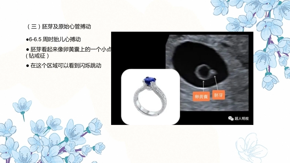 产科超声PPT正常妊娠超声表现异常妊娠 超声表现_第14页