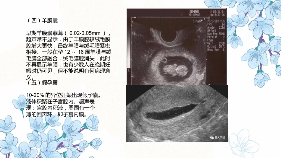产科超声PPT正常妊娠超声表现异常妊娠 超声表现_第15页