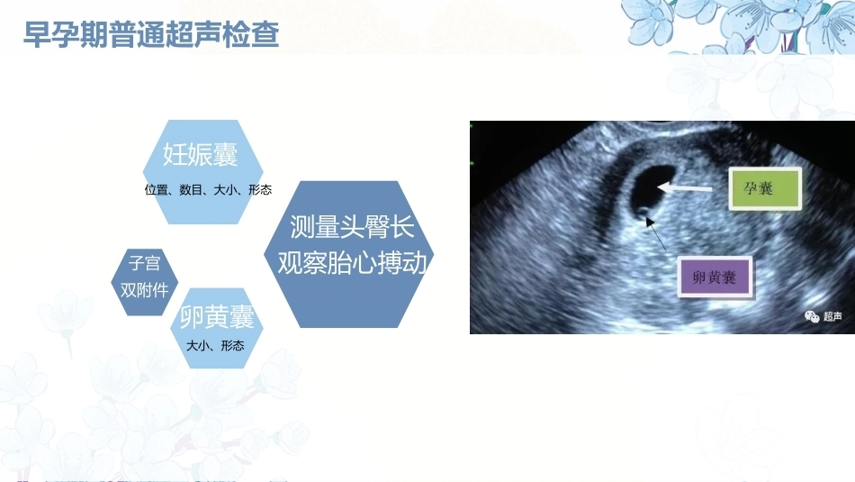 产科超声PPT正常妊娠超声表现异常妊娠 超声表现_第6页
