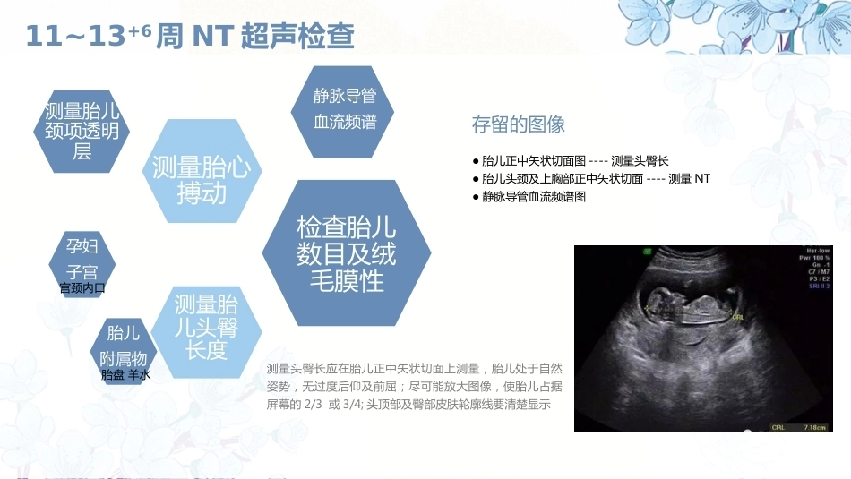 产科超声PPT正常妊娠超声表现异常妊娠 超声表现_第8页
