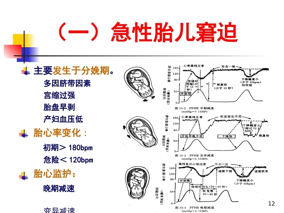 妇产科护理胎儿窘迫_第12页