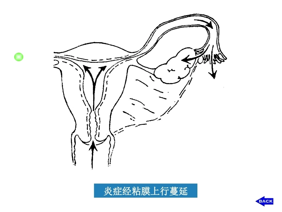 妇产科护理学_第11页