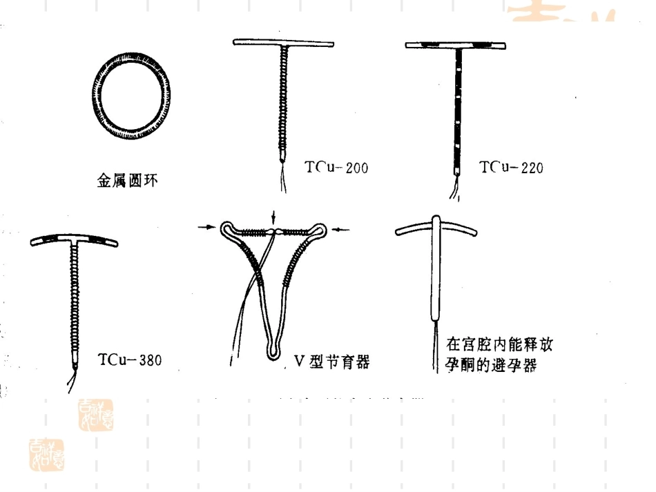 妇产科护理学-课程课件-计划生育妇女护理_第13页