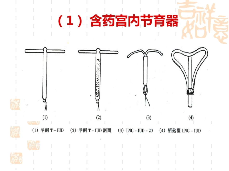 妇产科护理学-课程课件-计划生育妇女护理_第15页