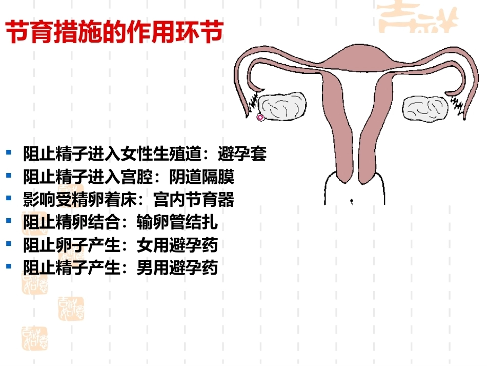 妇产科护理学-课程课件-计划生育妇女护理_第5页