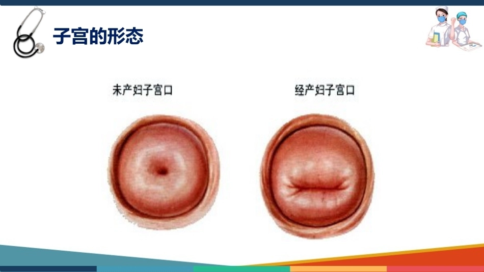 妇产科护理基础知识 子宫 妇产科护理课件_第8页