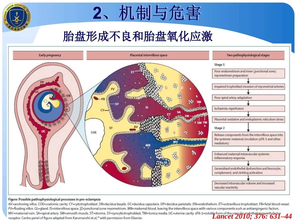 妊娠期高血压和妊娠高血压急症的处理_第12页