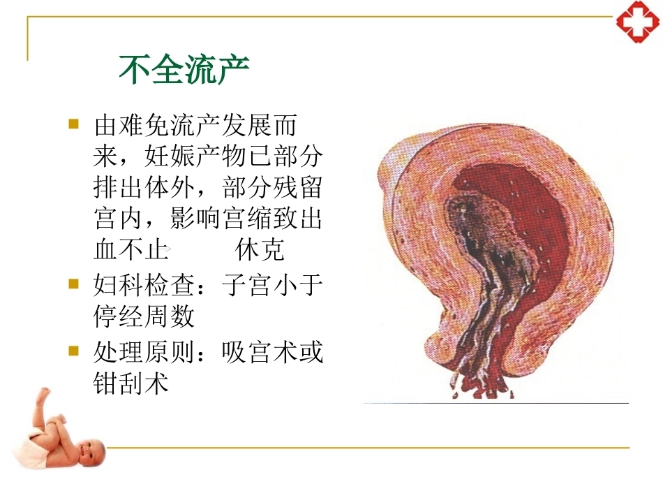 妊娠并发症妇女护理_第12页