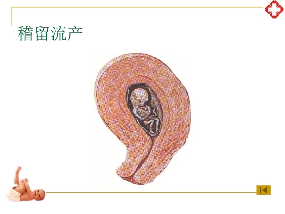 妊娠并发症妇女护理_第14页