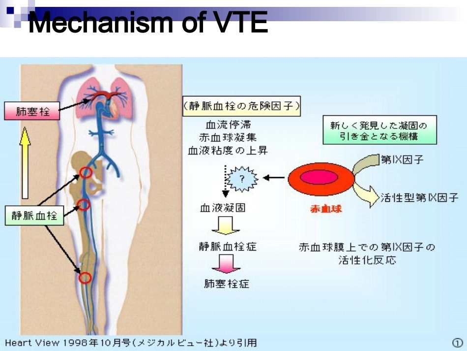 肺栓塞诊断与治疗_第4页