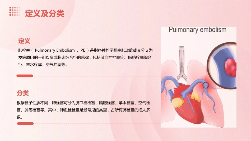 肺栓塞PPT演示课件_第4页
