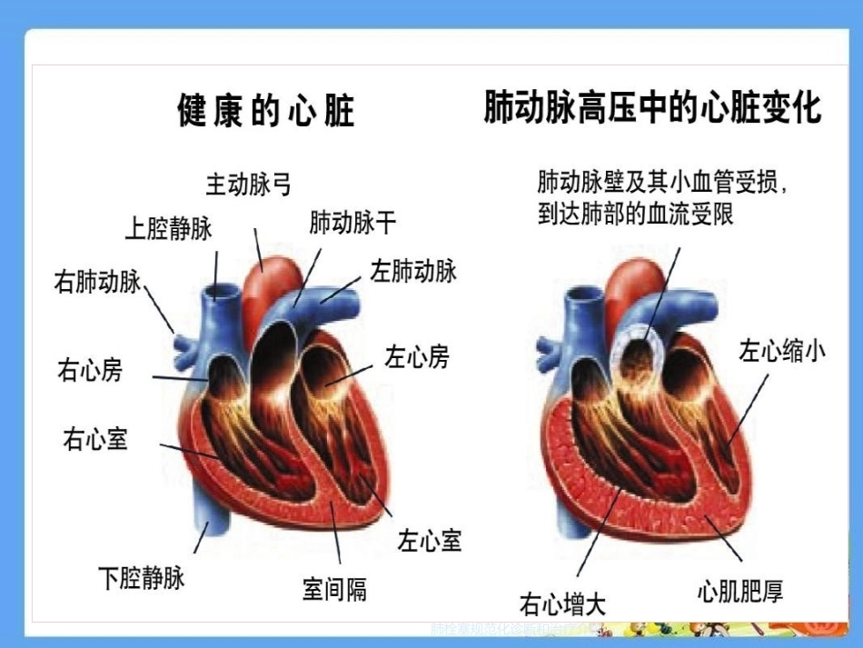 肺栓塞规范化诊断和治疗介绍_第10页