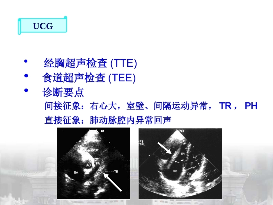 肺栓塞的诊断与预防策略_第15页