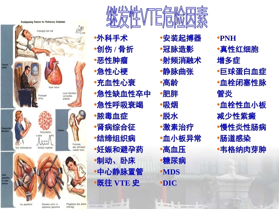 肺栓塞的诊断与预防策略_第7页