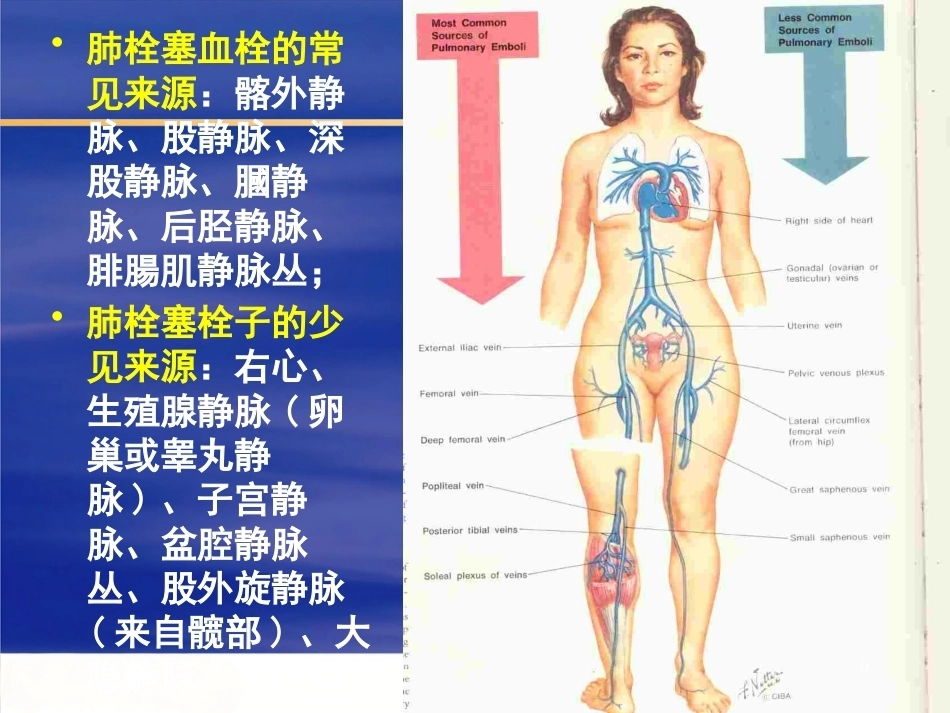 肺栓塞幻灯解读_第9页