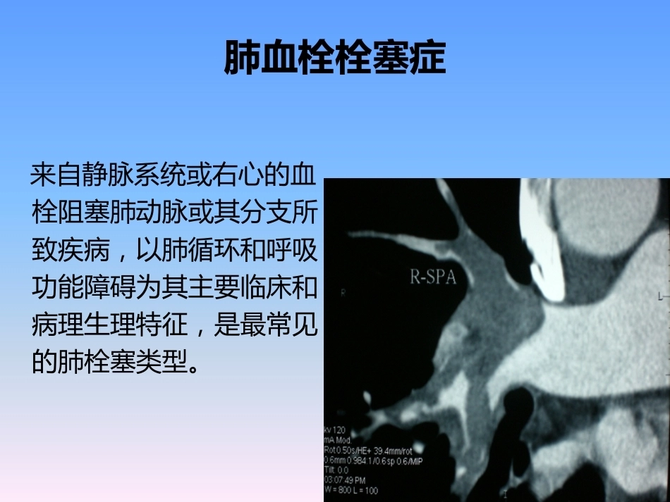 肺栓塞的防治与护理_第13页