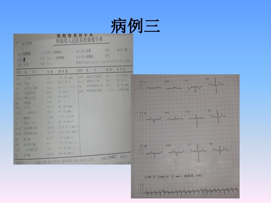 肺栓塞的防治与护理_第9页