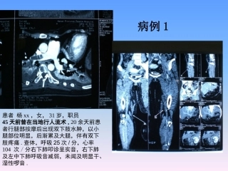 肺栓塞的防治与护理