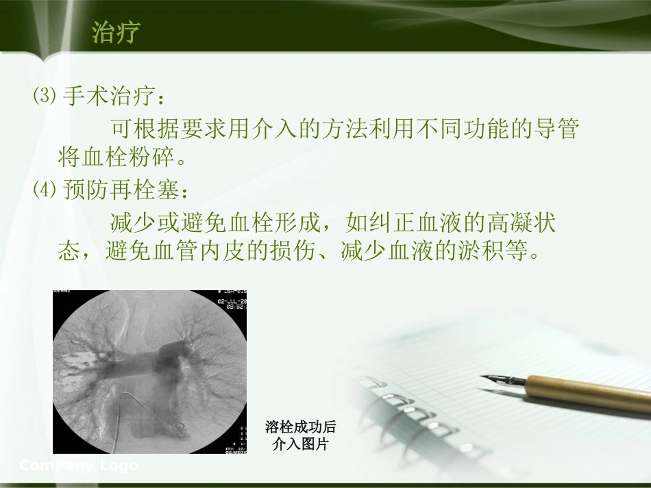 肺栓塞的业务学习PPT_第14页