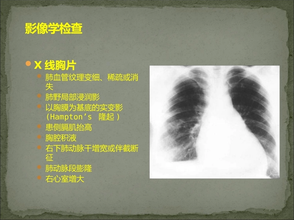 肺栓塞护理_第13页