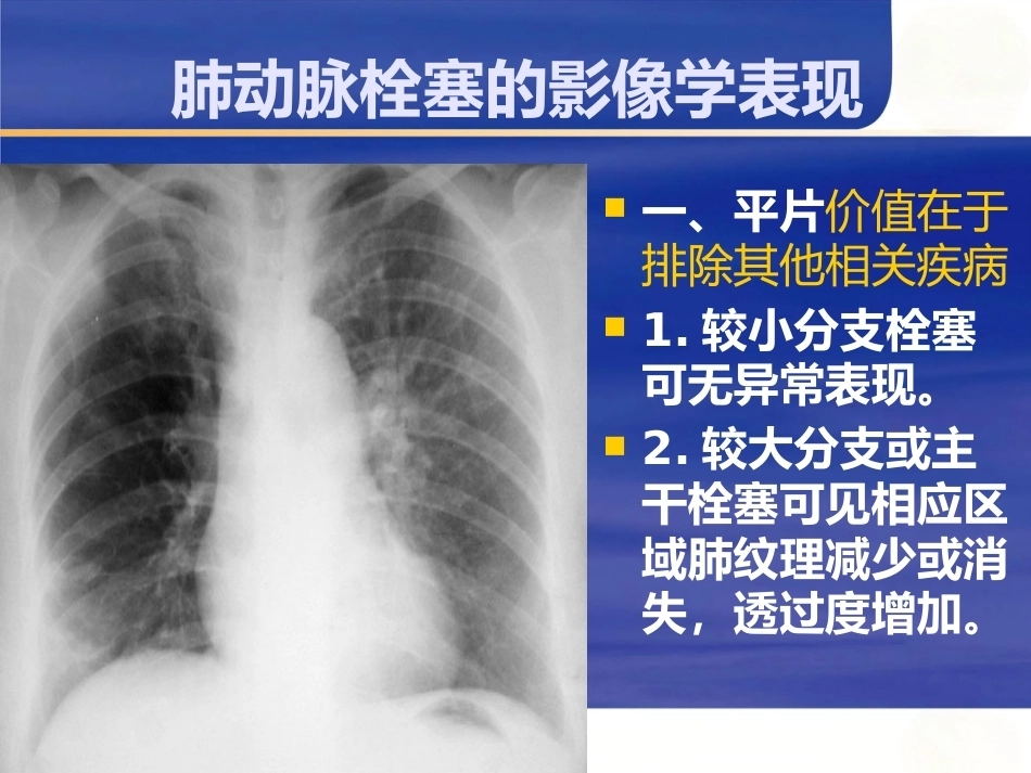 肺栓塞与肺梗死_第15页