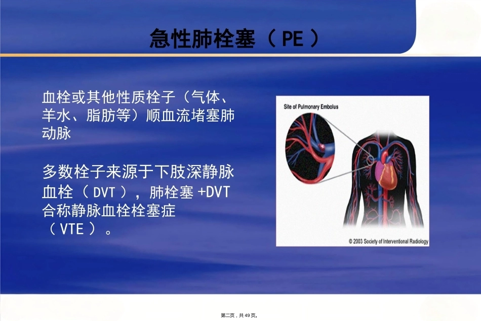肺栓塞诊断及鉴别诊断_第2页
