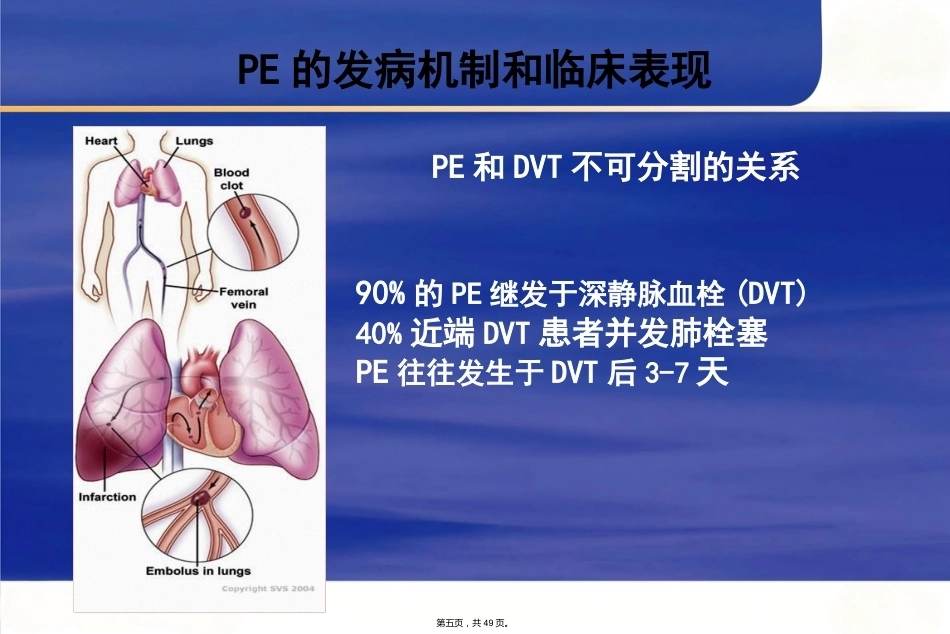 肺栓塞诊断及鉴别诊断_第5页