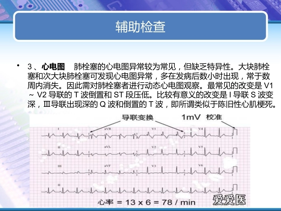 肺栓塞实用课件_第14页