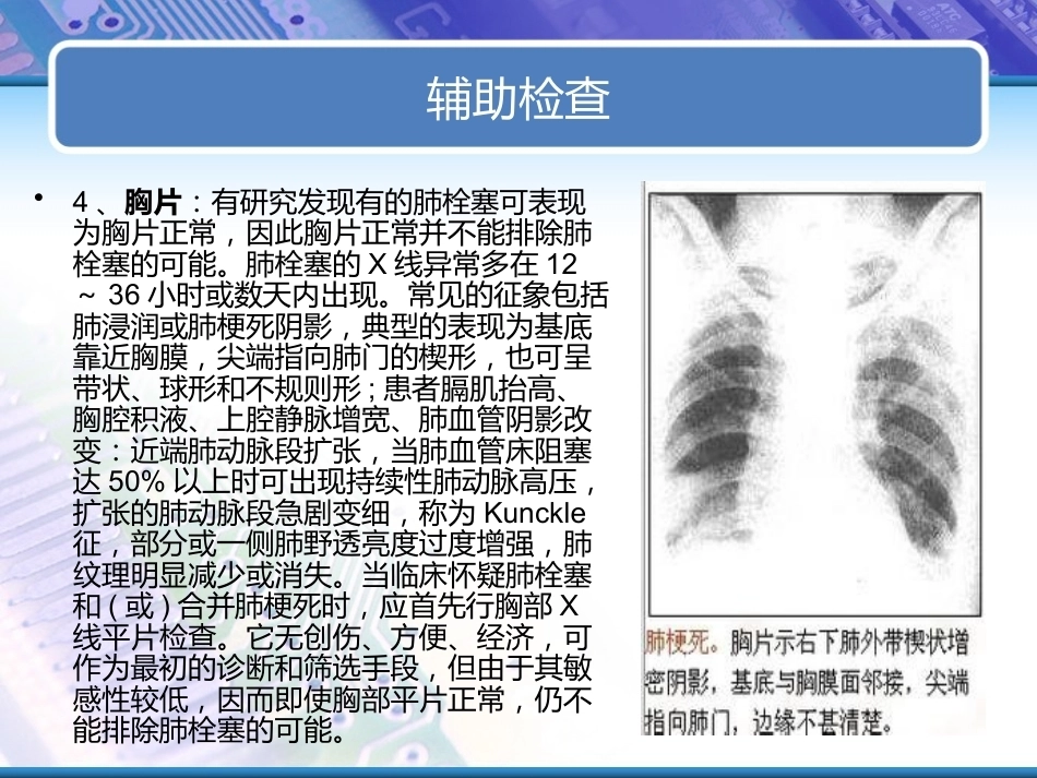 肺栓塞实用课件_第15页