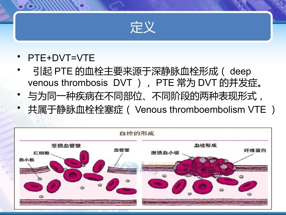 肺栓塞实用课件_第3页
