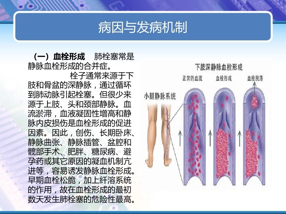 肺栓塞实用课件_第5页