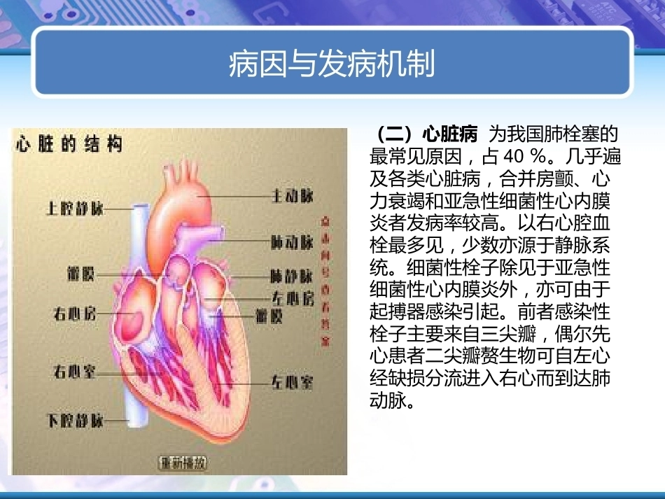 肺栓塞实用课件_第6页