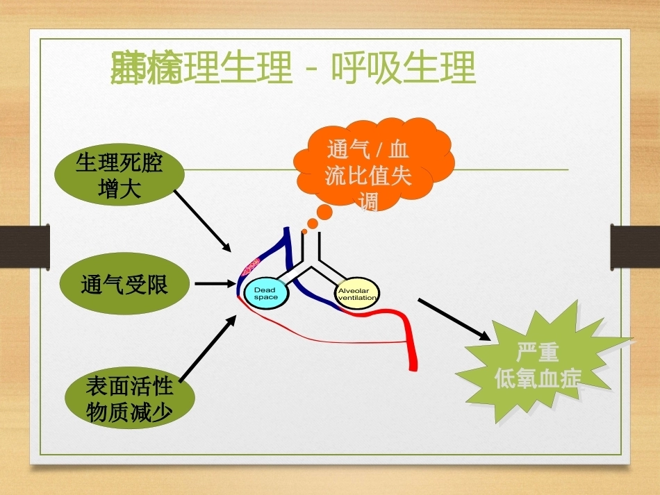 内科学肺栓塞_第12页
