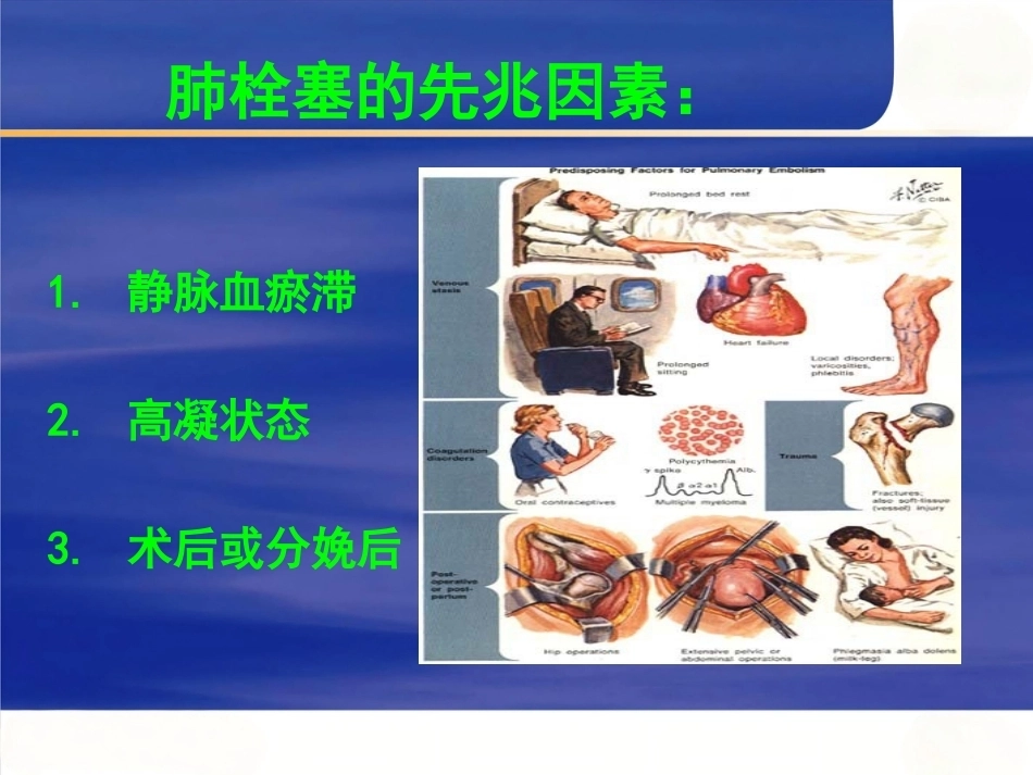 肺栓塞的病因及诊断_第7页