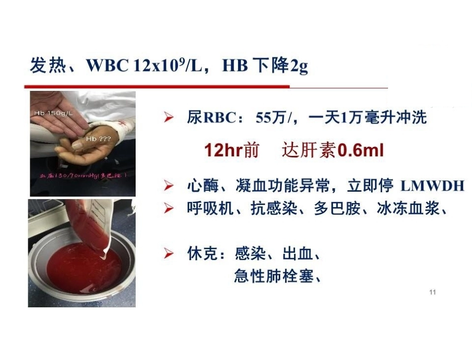 活动性出血与肺栓塞止血还是抗凝？_第11页
