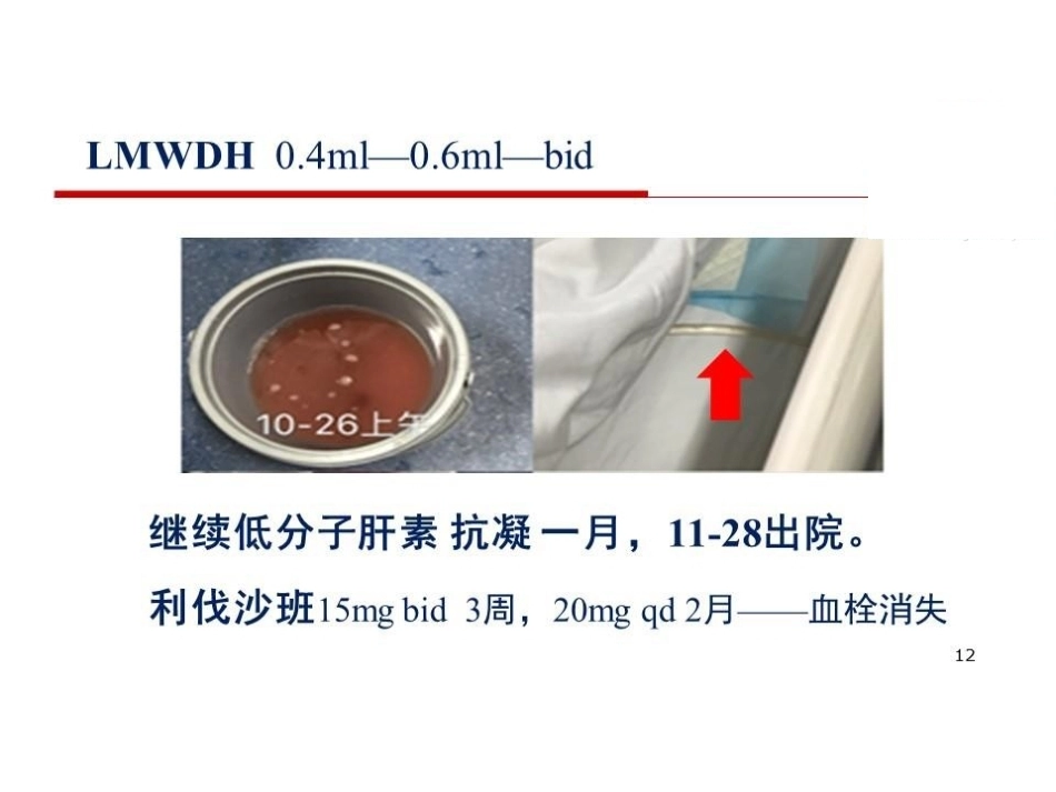 活动性出血与肺栓塞止血还是抗凝？_第12页
