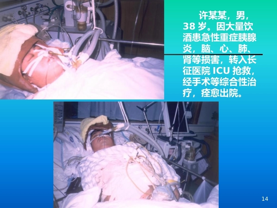 肺栓塞的诊疗进展PPT课件_第14页