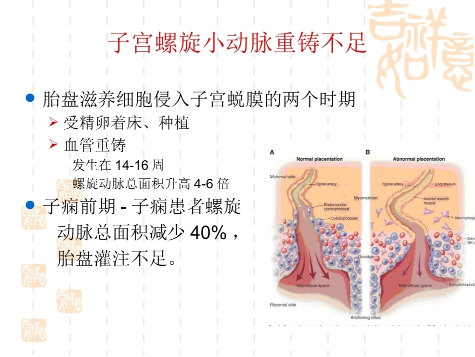 妊娠期高血压最新版_第5页