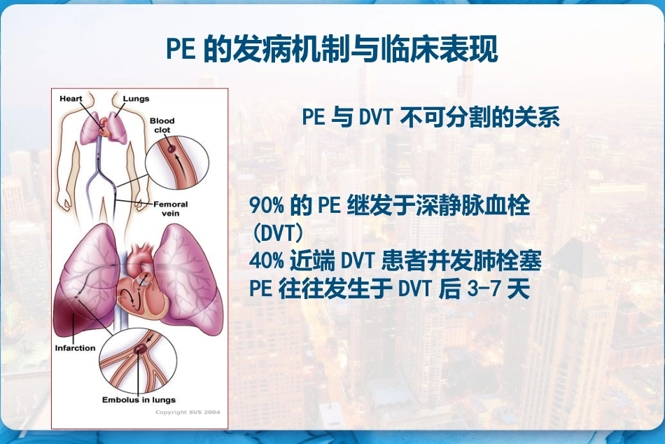 肺栓塞诊断及鉴别诊断 PPT_第4页