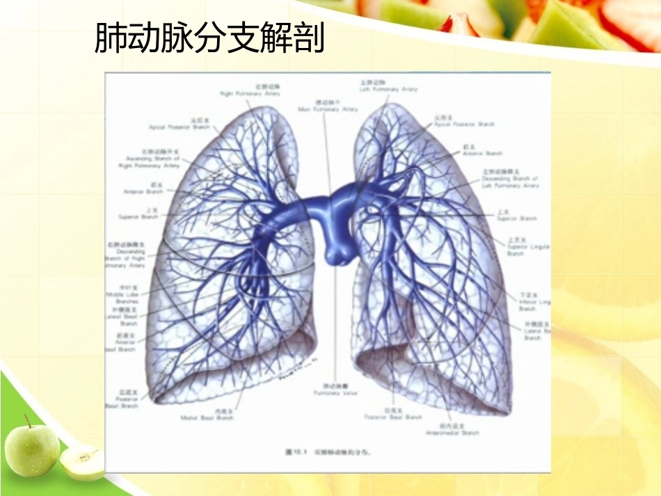 肺栓塞诊断演示_第7页