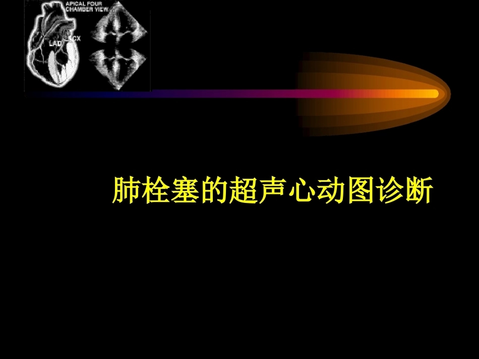 肺栓塞的超声心动图诊断ppt_第1页
