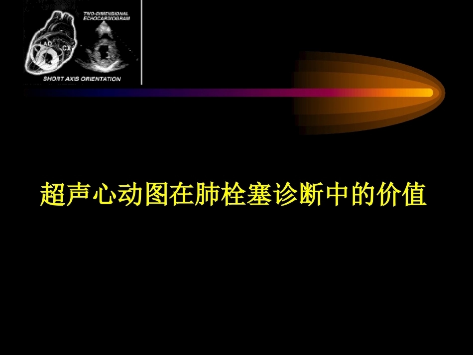 肺栓塞的超声心动图诊断ppt_第14页