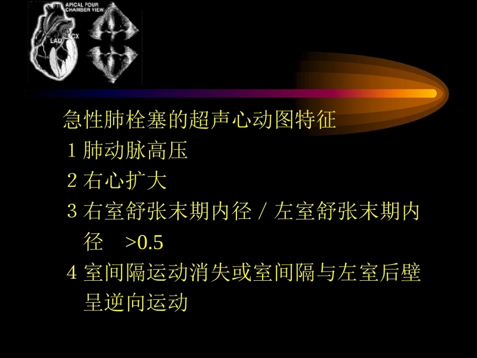 肺栓塞的超声心动图诊断ppt_第6页