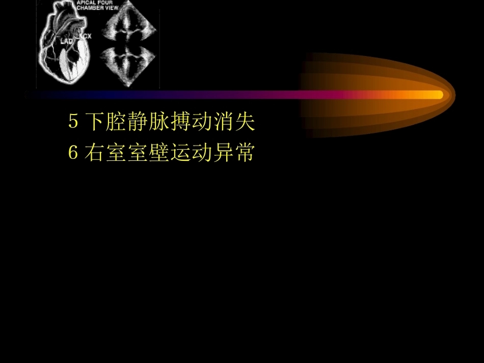 肺栓塞的超声心动图诊断ppt_第7页