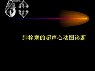 肺栓塞的超声心动图诊断ppt