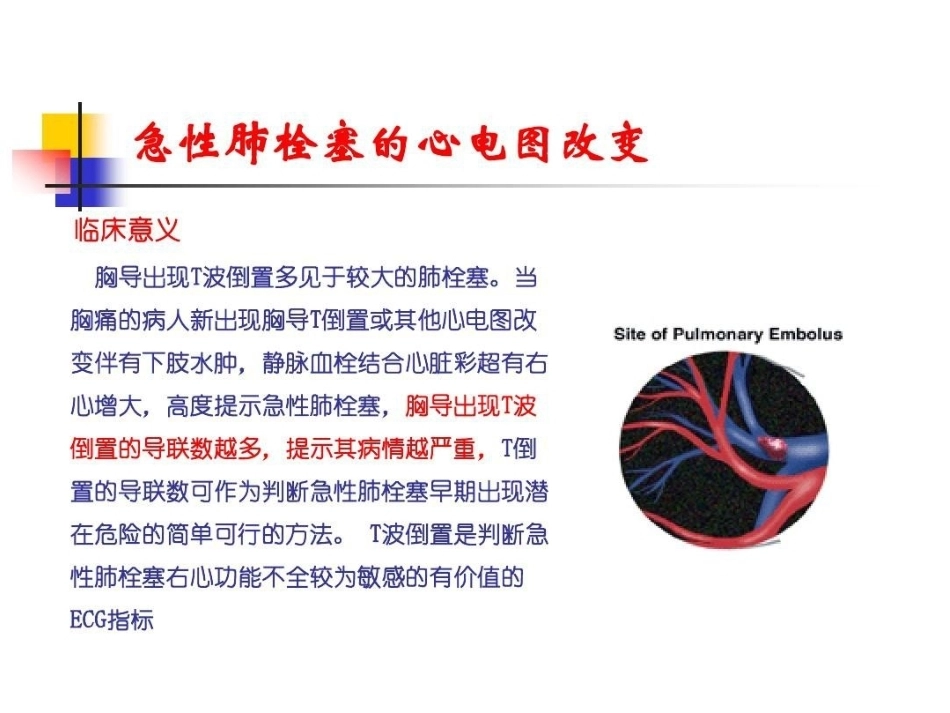 肺栓塞的ECG改变_第14页