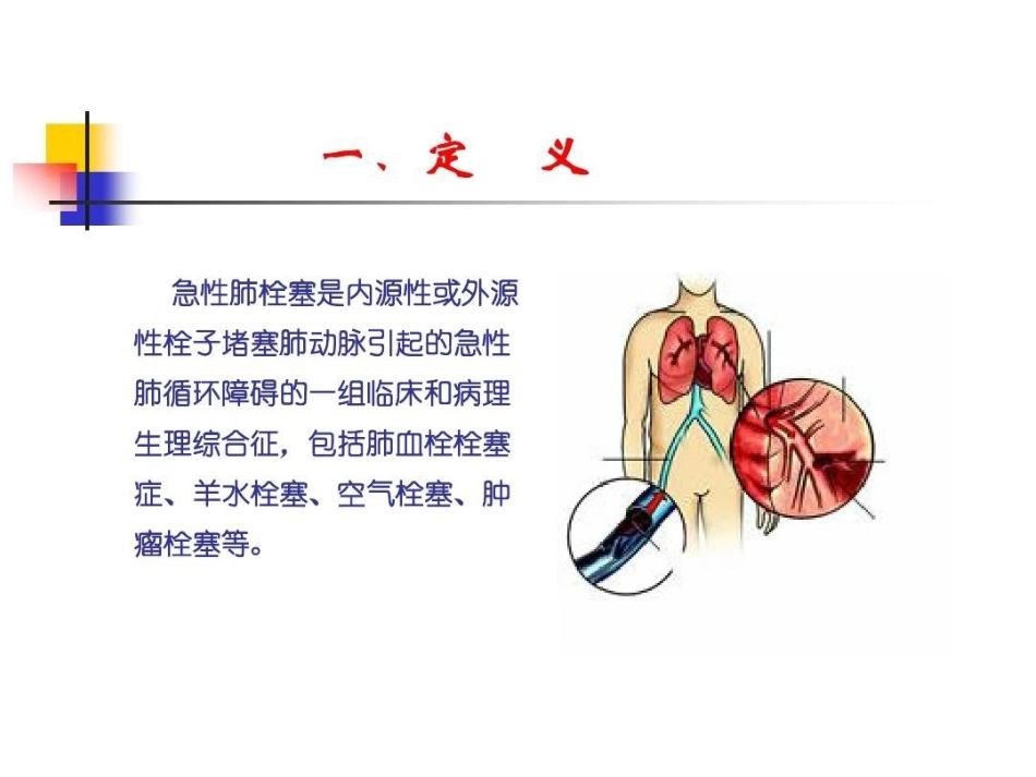 肺栓塞的ECG改变_第4页