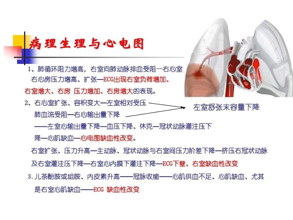 肺栓塞的ECG改变_第8页