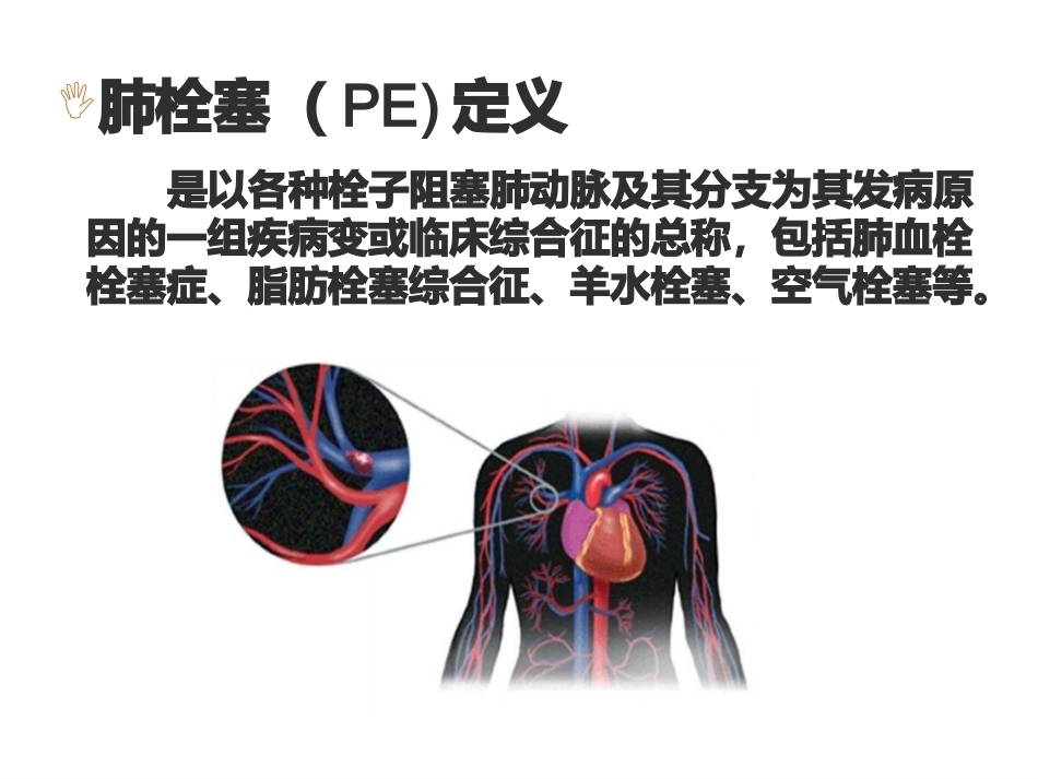 肺栓塞业务学习_第3页